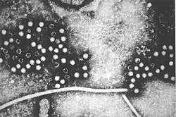Virus hepatitidy E