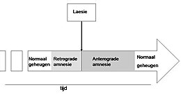 Amnesie.jpg görüntüsünün açıklaması.