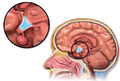 Hypothalamus a hypofýza