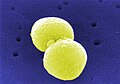 Streptococcus pneumoniae