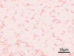 Shigella – Gramovo barvení.